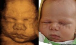 Let us open the window to their world
Located in Fairfax Va, InfantSee4D Ultrasound
is regarded as the most experienced, widely recognized and respected facilities serving the DC,NoVa,MD,& WV areas.
Providing elective state of the art 3D/4D imaging in